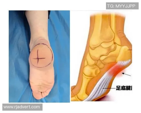 踢足球时是否必须穿足球袜对运动表现和安全性的影响探讨